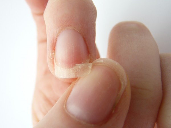 como fortalecer as unhas