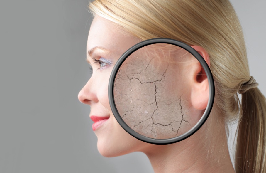 Rosto: pele vermelha e pele seca Rosto: pele vermelha e pele seca