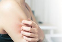 Alergia na pele – Como cuidar e prevenir alergia na pele
