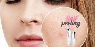 self peeling 9